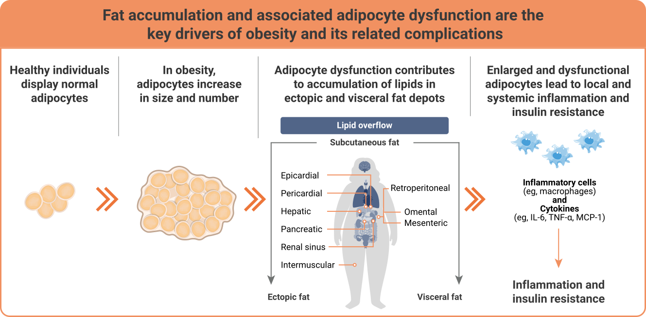 a graphic representation showing the accumulation of fat process with potential diseases due to this accumulation